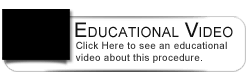 Dental Education Video - Dental Bonding Procedure